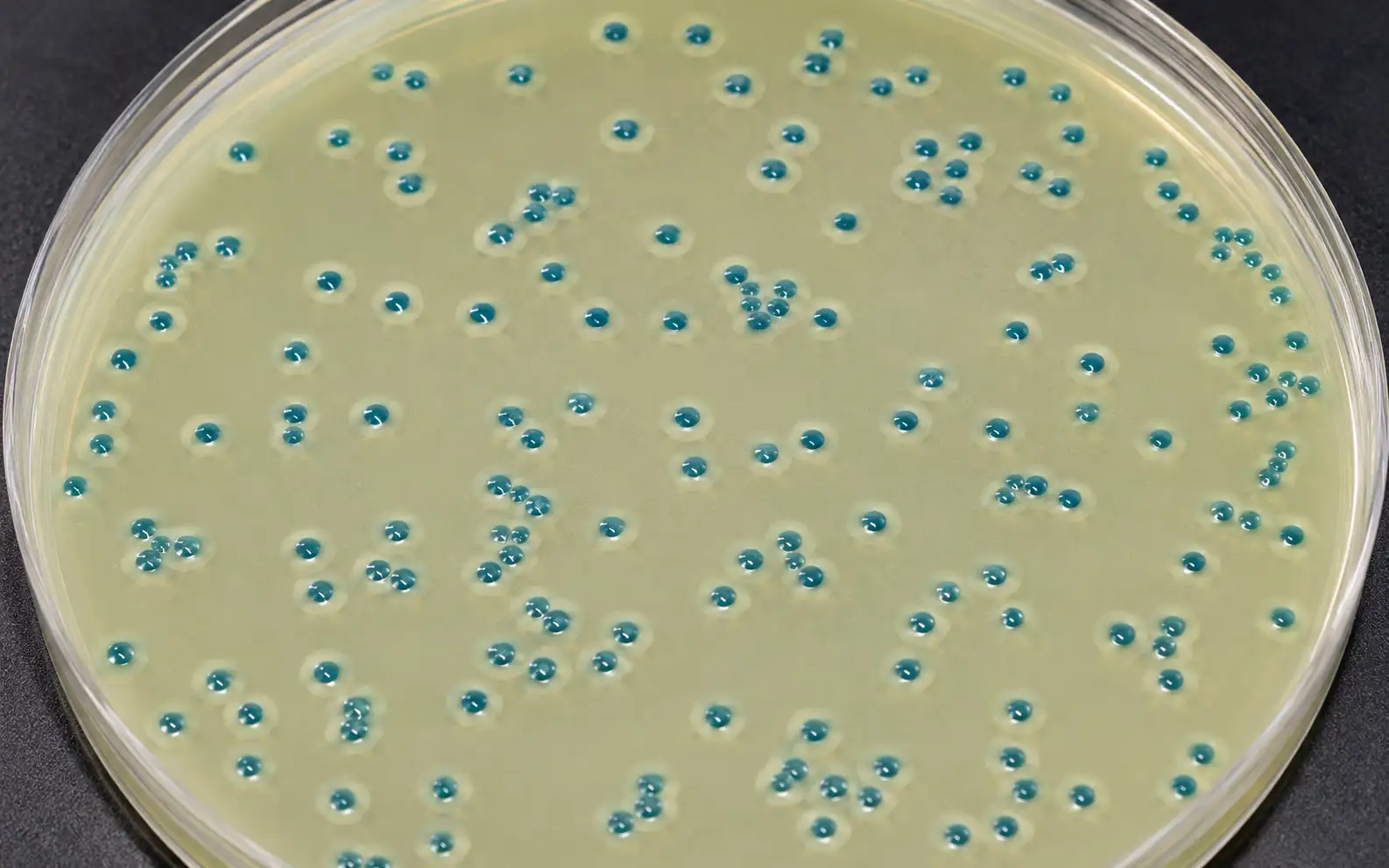 Listeria monocytogenes colonies showing characteristic blue-green halo on ALOA selective chromogenic agar